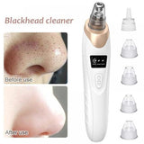 Electric Suction Blackhead Instrument Home Beauty Instrument Blackhead Pore Cleaning (rechargable)